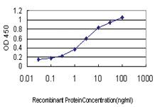 Anti-ST3GAL2 Mouse Monoclonal Antibody [clone: 1E12]