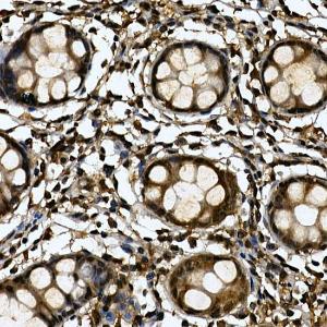 Immunohistochemistry analysis of paraffin-embedded human colon tissue using Anti-Tankyrase binding protein 1 Antibody (A308531) at a dilution of 1:200 (40x lens) Perform high pressure antigen retrieval with 10 mM citrate buffer pH 60 before commencing with IHC staining protocol