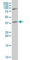 Anti-ST3GAL4 Mouse Polyclonal Antibody