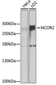 Western blot analysis of extracts of various cell lines, using Anti-NCOR2/SMRT Antibody (A10415) at 1:1,000 dilution The secondary antibody was Goat Anti-Rabbit IgG H&L Antibody (HRP) at 1:10,000 dilution Lysates/proteins were present at 25 µg per lane