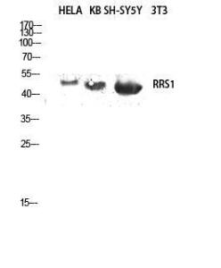 Western blot analysis of HELA KB SH SY5Y lysis using Anti-RRS1 Antibody