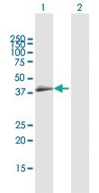 Anti-CCRL2 Rabbit Polyclonal Antibody