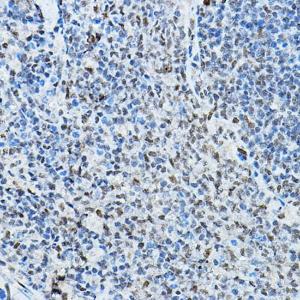 Immunohistochemistry analysis of paraffin-embedded rat spleen using Anti-NCOR2/SMRT Antibody (A10415) at a dilution of 1:100 (40x lens) Perform high pressure antigen retrieval with 10 mM citrate buffer pH 60 before commencing with IHC staining protocol