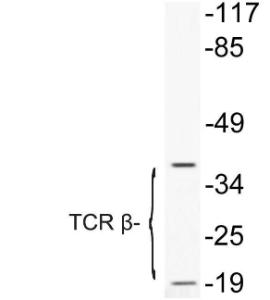 Anti-TCR beta antibody