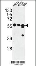 Anti-CNOT4 Rabbit Polyclonal Antibody