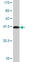 Anti-CTGF Mouse Monoclonal Antibody [clone: 2C11]