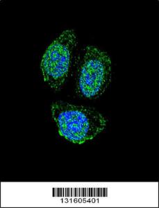 Anti-IL17B Rabbit Polyclonal Antibody (Biotin)