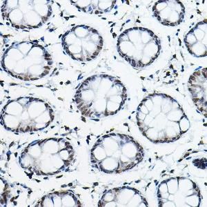 Immunohistochemistry analysis of paraffin-embedded human colon tissue using Anti-NCOR2/SMRT Antibody (A10415) at a dilution of 1:100 (40x lens) Perform high pressure antigen retrieval with 10 mM citrate buffer pH 60 before commencing with IHC staining protocol