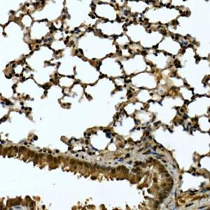 Immunohistochemistry analysis of paraffin-embedded mouse lung using Anti-Tankyrase binding protein 1 Antibody (A308531) at a dilution of 1:200 (40x lens) Perform high pressure antigen retrieval with 10 mM citrate buffer pH 60 before commencing with IHC staining protocol