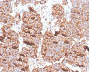 Immunohistochemical analysis of formalin-fixed, paraffin-embedded human pituitary tissue using Anti-Prolactin Antibody [PRL/4906R]