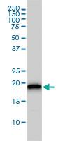 Anti-UBE2M Mouse Monoclonal Antibody [clone: 3C4]