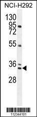 Anti-AKIP1 Rabbit Polyclonal Antibody (FITC (Fluorescein Isothiocyanate))