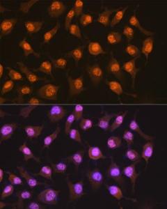 Anti-PER2 Rabbit Monoclonal Antibody [clone: ARC1134]