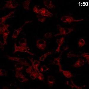 Macrophages stained with Anti-RAB14 Antibody at a 1:50 dilution