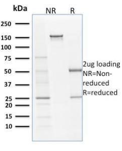 SDS-PAGE analysis of Anti-Filaggrin Antibody [SPM181] under non-reduced and reduced conditions; showing intact IgG and intact heavy and light chains, respectively. SDS-PAGE analysis confirms the integrity and purity of the antibody