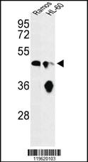 Anti-ENO1 Rabbit Polyclonal Antibody