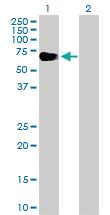 Anti-EYA2 Rabbit Polyclonal Antibody