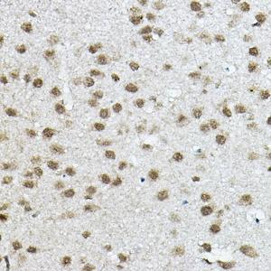 Immunohistochemistry analysis of paraffin-embedded mouse brain using Anti-NCOR2/SMRT Antibody (A10415) at a dilution of 1:100 (40x lens) Perform high pressure antigen retrieval with 10 mM citrate buffer pH 60 before commencing with IHC staining protocol