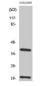 Anti-TCR beta antibody