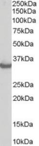 Anti-STUB1 / CHIP Goat Polyclonal Antibody