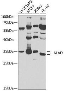 Anti-ALAD Rabbit Polyclonal Antibody