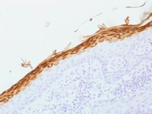 Immunohistochemical analysis of formalin-fixed, paraffin-embedded human skin using Anti-Filaggrin Antibody [FLG/1562]