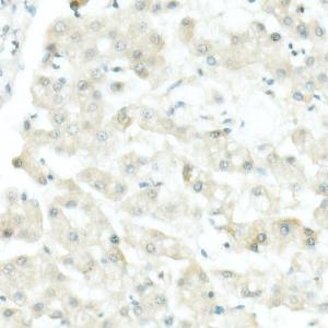 Anti-Tyrosinase Rabbit Monoclonal Antibody [clone: ARC53166]