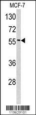 Anti-EPN3 Rabbit Polyclonal Antibody