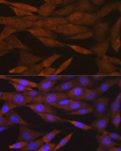 Anti-PER2 Rabbit Monoclonal Antibody [clone: ARC1134]