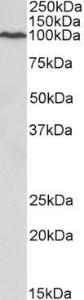 Anti-CDC48 Antibody (A82483) (03 µg/ml) staining of HeLa lysate (35 µg protein in RIPA buffer) Primary incubation was 1 hour Detected by chemiluminescence