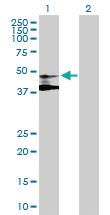 Anti-ST3GAL3 Mouse Polyclonal Antibody