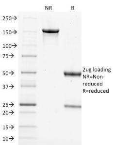 SDS-PAGE analysis of Anti-Filaggrin Antibody [FLG/1562] under non-reduced and reduced conditions; showing intact IgG and intact heavy and light chains, respectively. SDS-PAGE analysis confirms the integrity and purity of the antibody