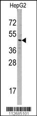 Anti-SNX6 Rabbit Polyclonal Antibody