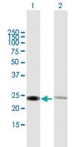 Anti-RPL14 Mouse Polyclonal Antibody