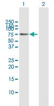 Anti-GLMN Rabbit Polyclonal Antibody