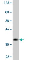 Anti-TAOK2 Mouse Monoclonal Antibody [clone: 3E2]