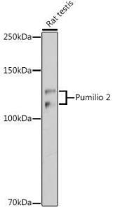 Western blot analysis of extracts of Rat testis, using Anti-Pumilio 2 Antibody [ARC2308] (A307557) at 1:1,000 dilution. The secondary antibody was Goat Anti-Rabbit IgG H&L Antibody (HRP) at 1:10,000 dilution.