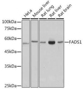 Western blot analysis of extracts of various cell lines, using Anti-FADS1 Antibody [ARC2499] (A308532) at 1:1,000 dilution