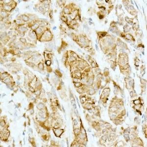 Anti-Tyrosinase Rabbit Monoclonal Antibody [clone: ARC53166]