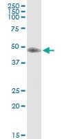 Anti-ST3GAL3 Rabbit Polyclonal Antibody