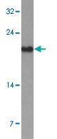 Anti-TDGF1 Rabbit Polyclonal Antibody