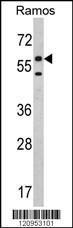 Anti-ETFDH Rabbit Polyclonal Antibody (AP (Alkaline Phosphatase))