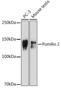 Western blot analysis of extracts of various cell lines, using Anti-Pumilio 2 Antibody [ARC2308] (A307557) at 1:500 dilution. The secondary antibody was Goat Anti-Rabbit IgG H&L Antibody (HRP) at 1:10,000 dilution.