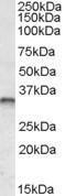 Anti-JUNB Antibody (A82485) (0.3 µg/ml) staining of Human Breast Cancer lysate (35 µg protein in RIPA buffer). Primary incubation was 1 hour. Detected by chemiluminescence