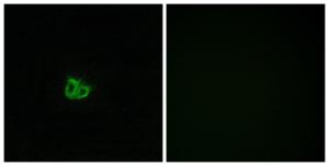 Immunofluorescence analysis of COS7 cells using Anti-Stathmin 1 (phospho Ser15) Antibody. The right hand panel represents a negative control, where the antibody was pre-incubated with the immunising peptide