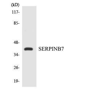 Western blot analysis of the lysates from Jurkat cells using Anti-SERPINB7 Antibody