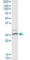 Anti-RPL14 Rabbit Polyclonal Antibody