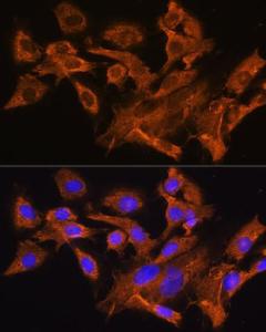 Immunofluorescence analysis of C6 cells using Anti-AVPR1A / V1aR Antibody (A10419) at a dilution of 1:100. DAPI was used to stain the cell nuclei (blue).