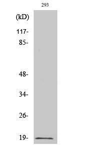 Western blot analysis of various cells using Anti-Stathmin 1 (phospho Ser15) Antibody