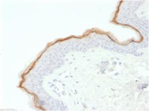 Immunohistochemical analysis of formalin-fixed, paraffin-embedded human skin using Anti-Filaggrin Antibody [FLG/1563]